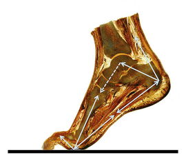 Der Windlass-Mechanismus