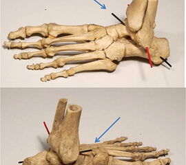 Näherungsweise Achse des Subtalargelenks (blauer Pfeil) und des OSG (rot)