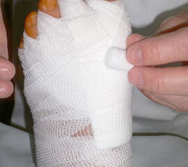 Redressierender Zehenverband