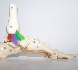 Anatomie des medialen Kapsel-Band-Apparats (grün: tibionaviculares Ligament (TNL); blau: anteriores tibiotalares Ligament (ATTL); violett: tibiocalcaneares Ligament (TCL); rot: posteriores tibiotalares Ligament (PTTL).