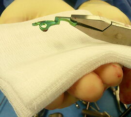 Vorbiegen der TOM-Platte (Photo)