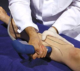 Flexoren des Unterschenkels: Behandlung mit der radialen Stoßwelle entlang der medialen Tibiakante. Applikator 20 mm. (Mit frdl. Genehmigung durch Level-10-Buchverlag, Heilbronn und Storz Medical AG)