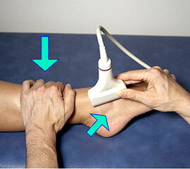Durch Druck auf die ventrale Tibia läßt sich der Talusvorschub testen