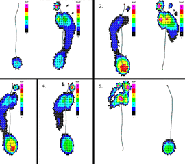 Standphasen in der Pedobarografie am Beispiel des linken Fußes